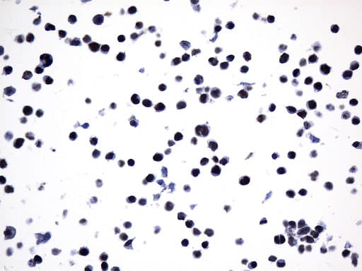 FOXP1 Antibody (clone UMAB242)