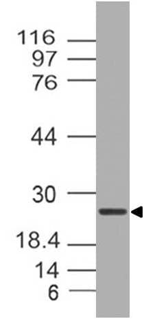 TICAM2 / TRAM Antibody