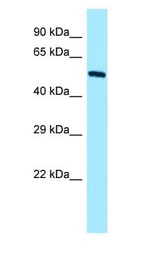 KRT4 / CK4 / Cytokeratin 4 Antibody (aa94-143)