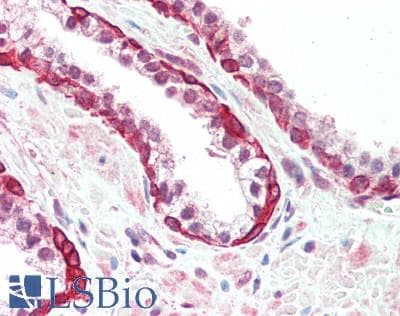 IHC-plus™ VAV3 Antibody (aa200-250)