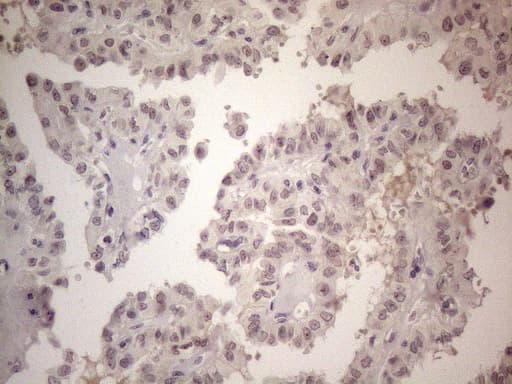 CSA / ERCC8 Antibody (clone OTI2G1, Carrier-free)