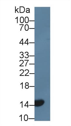 p16INK4a / CDKN2A Antibody (aa3-155, Mouse sequence)