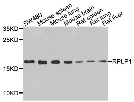 Polyclonal Rabbit anti-Human RPLP1 Antibody (IHC, IF, WB)