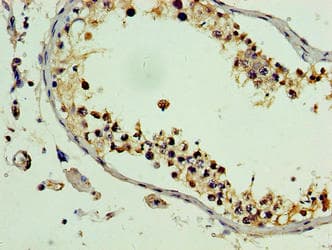 Polyclonal Rabbit anti-Human PLEKHB2 Antibody (aa1-222, IHC)