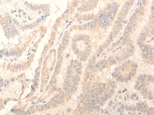 ADGRE3 / EMR3 Antibody