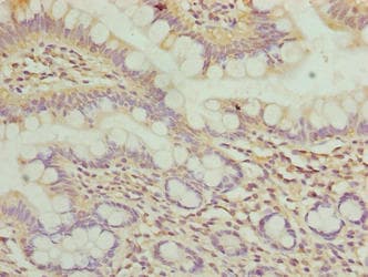 WDR66 Antibody