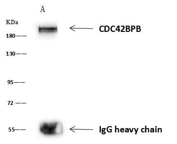 Polyclonal Rabbit anti-Human CDC42BPB / MRCKB Antibody (WB)