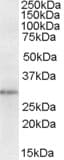 IHC-plus™ NQO1 Antibody (aa263-274)