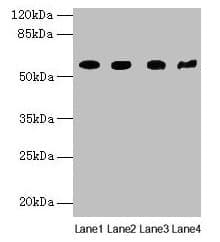 Polyclonal Rabbit anti-Human KRT79 / Keratin 79 Antibody