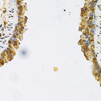 HSP90AB1 / HSP90 Alpha B1 Antibody