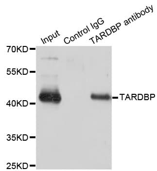 TDP-43 / TARDBP Antibody