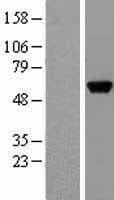 GPT / Alanine Transaminase Protein (Over-Expression Lysate Myc-DDK (Flag))