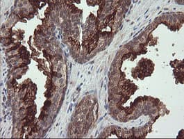 MME / CD10 Antibody (clone OTI3D11)