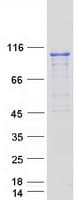 Human PRPF6 / TOM Protein (Recombinant Myc-DDK (Flag))