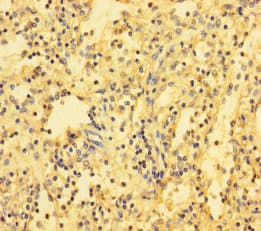 TARSH / ABI3BP Antibody