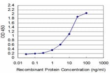 Monoclonal Mouse anti-Human TESK2 Antibody (clone 5G1, WB)