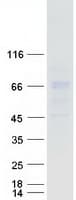 Human ACCN1 / ASIC2 Protein (Recombinant Myc-DDK (Flag))