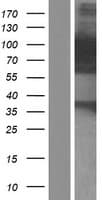 PALLD / Palladin Protein (Over-Expression Lysate Myc-DDK (Flag))