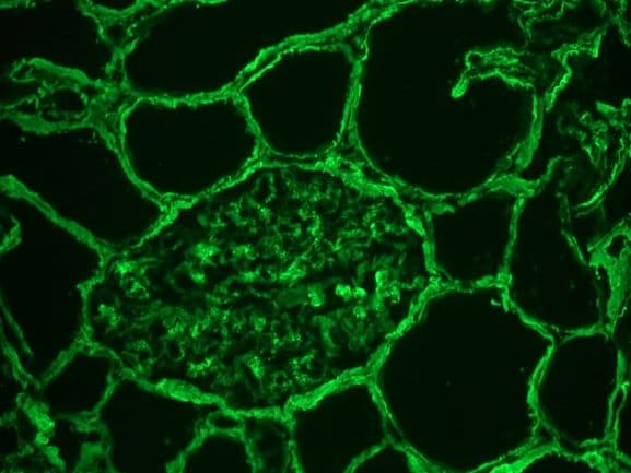 PathPlus™ Collagen IV Antibody