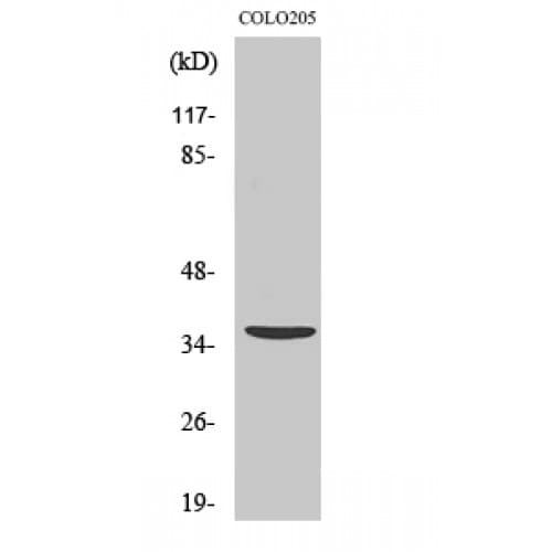 APIP Antibody (260-340 aa, C-terminal)