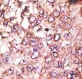Polyclonal Rabbit anti-Human AUTL1 / ATG4C Antibody (aa167-196, IHC, WB)