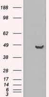 Monoclonal Mouse anti-Human GFAP Antibody (clone OTI1E11, IF, WB)