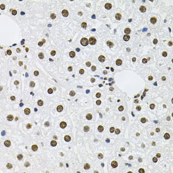 Polyclonal Rabbit anti-Human MCL1 / MCL 1 Antibody (IHC, IF, WB)