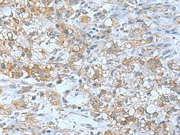 TSGA10 Antibody