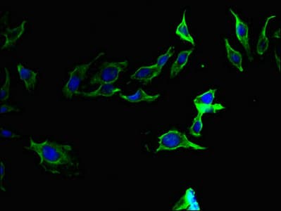 F2 / Prothrombin / Thrombin Antibody