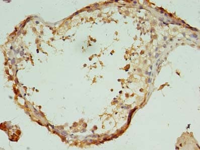 Polyclonal Rabbit anti-Human C7orf62 Antibody (IHC, WB)