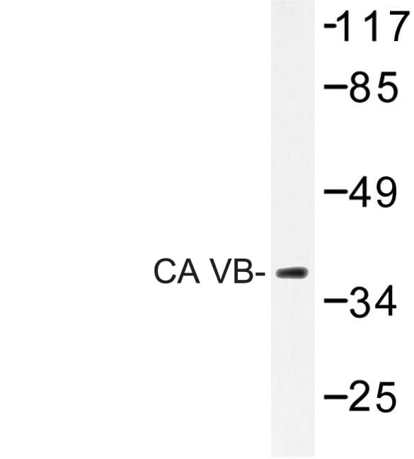 CA-VB / CA5B Antibody (Asn280)