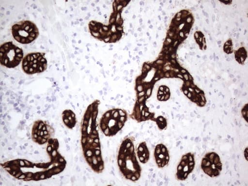 KRT16 / CK16 / Cytokeratin 16 Antibody (clone OTI2H8)