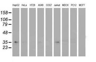 GRHPR / Glyoxylate Reductase Antibody (clone OTI4H2, Carrier-free)