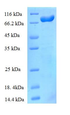 E. coli nrdD Protein (Recombinant His)