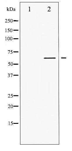 Polyclonal Rabbit anti-Human p56lck / LCK Antibody (phospho-Tyr505, IHC, WB)