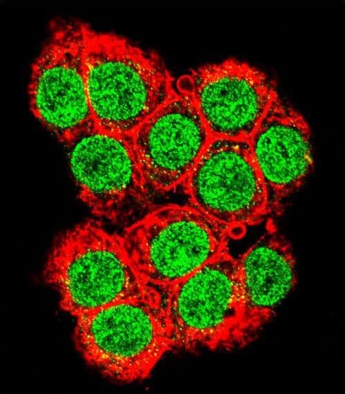 XRCC6 / Ku70 Antibody (aa521-548)