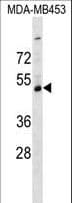 SERPINI2 / PANCPIN Antibody (aa375-401)