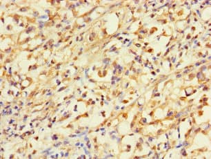 Polyclonal Rabbit anti-Human ACLY / ATP Citrate Lyase Antibody (IHC)
