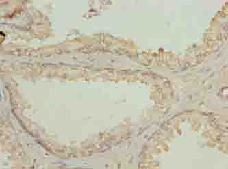 N4BP2L2 Antibody
