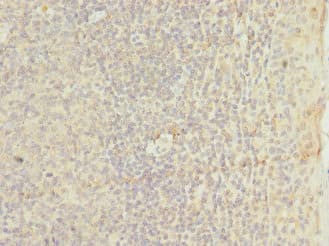 Polyclonal Rabbit anti-Human TM9SF3 Antibody (IHC)