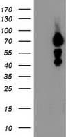Monoclonal Mouse anti-Human KATNB1 Antibody (clone OTI5A6, WB)