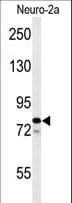 FAM91A1 Antibody (aa127-155)