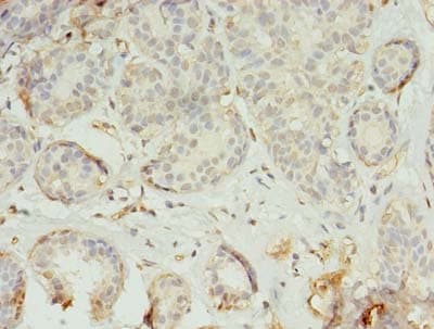 TMEM45A Antibody