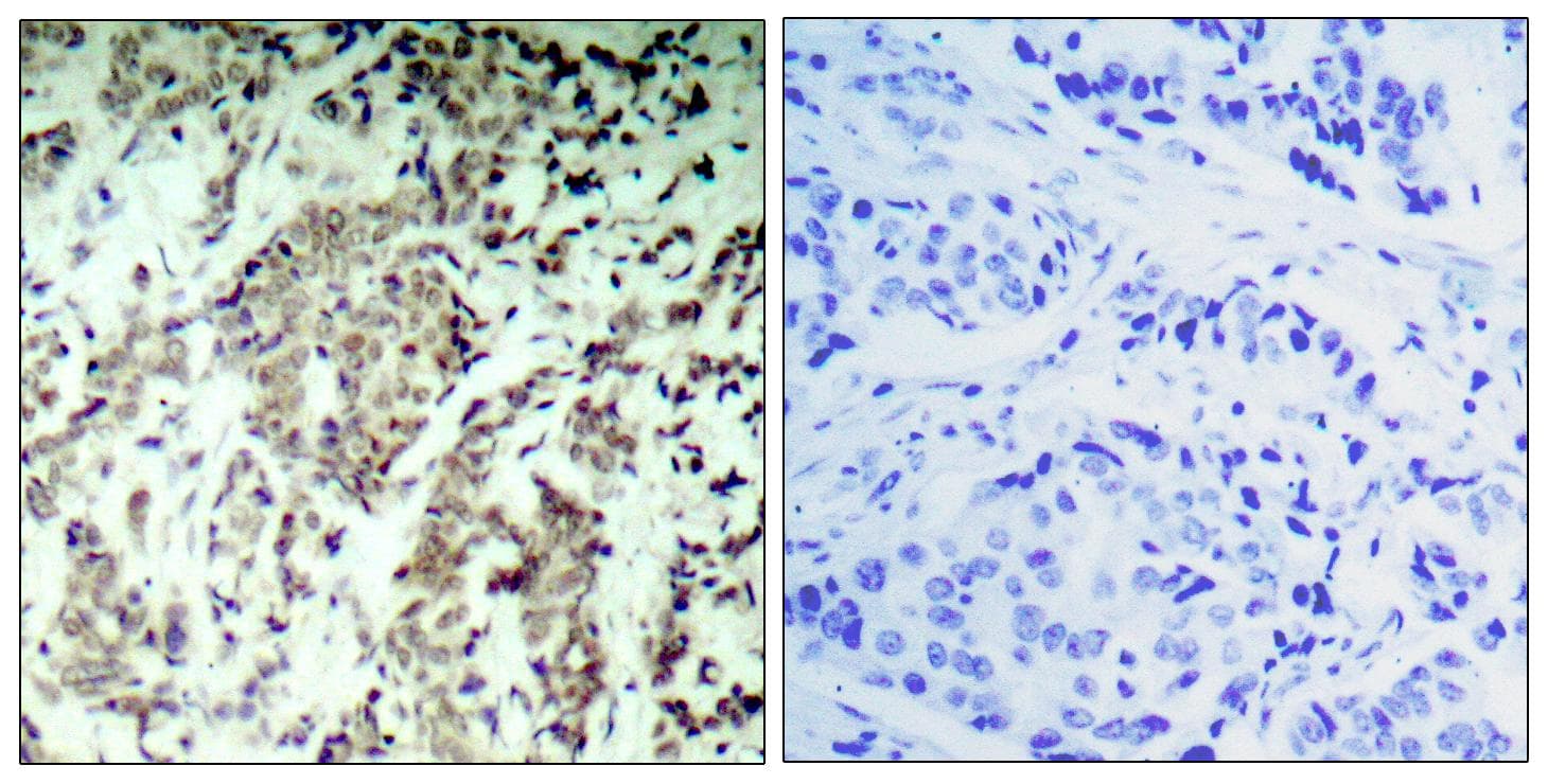 TP53 / p53 Antibody (p15)