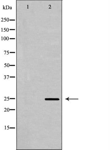 Polyclonal Rabbit anti-Human UCHL1 / PGP9.5 Antibody (IHC, IF, WB)