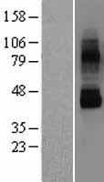 TRPV6 Protein (Over-Expression Lysate Myc-DDK (Flag))