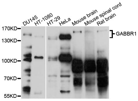 GABBR1 / GABA B Receptor 1 Antibody