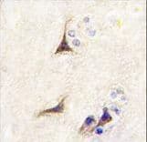Polyclonal Rabbit anti-Human NGF Antibody (aa84-115, IHC, IF, WB)