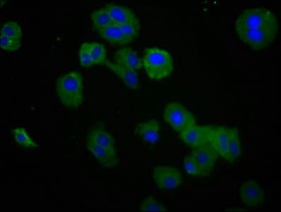 Polyclonal Rabbit anti-Human NKG2DL4 / ULBP4 Antibody (IHC)