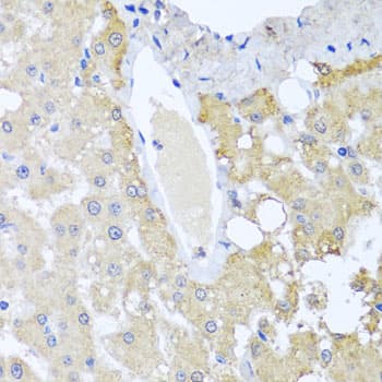 SULT1A1 / Sulfotransferase 1A1 Antibody